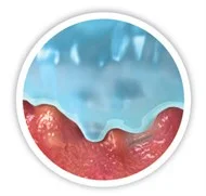 Yara Yatağına Mikro Konturların Çizimi