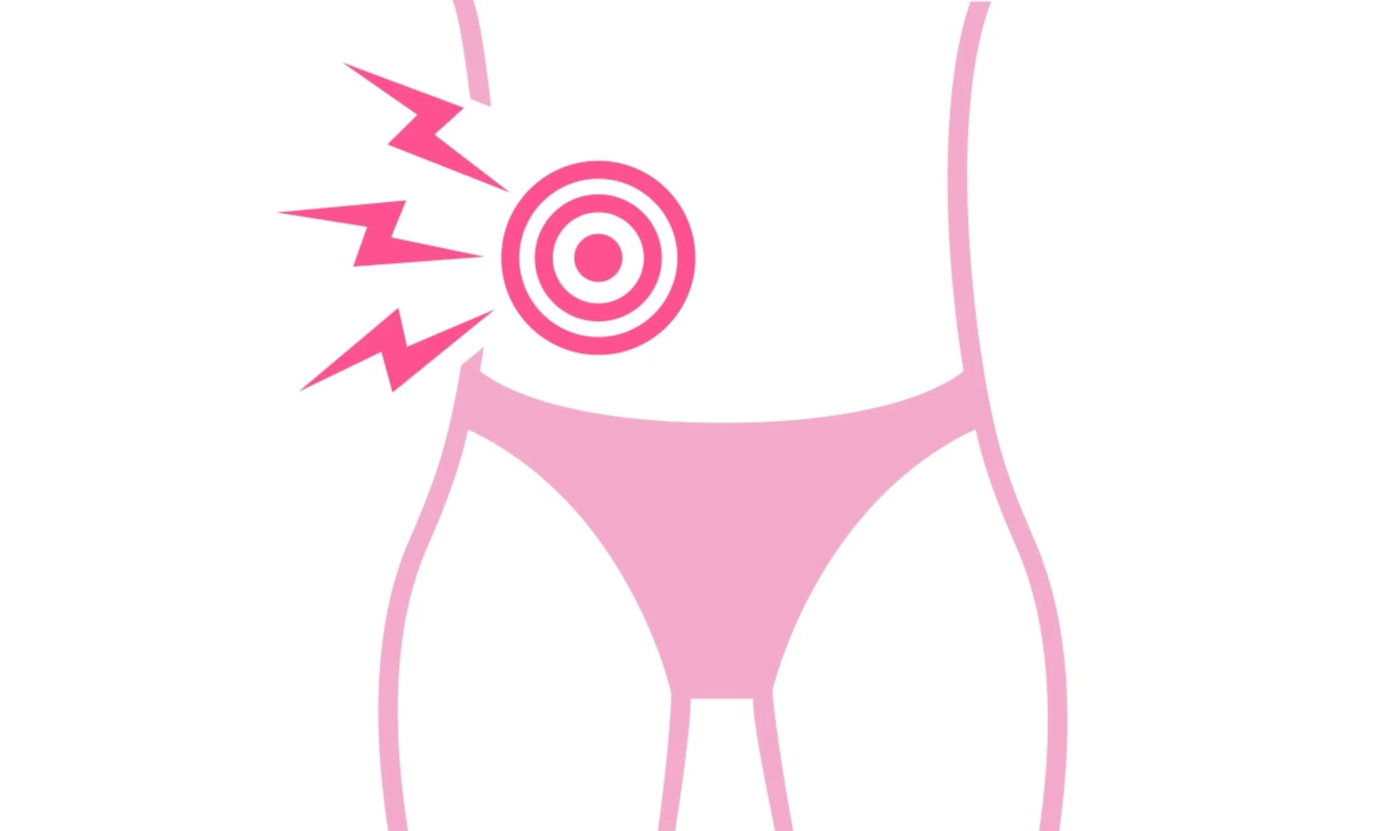 damaged peristomal skin graphic