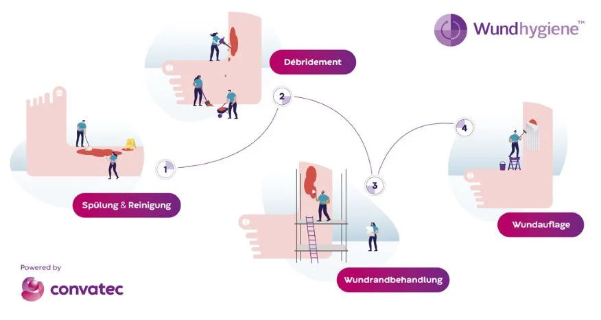 Wundhygiene Konzept: Vier einfache Schritte für eine optimale Wundversorgung 