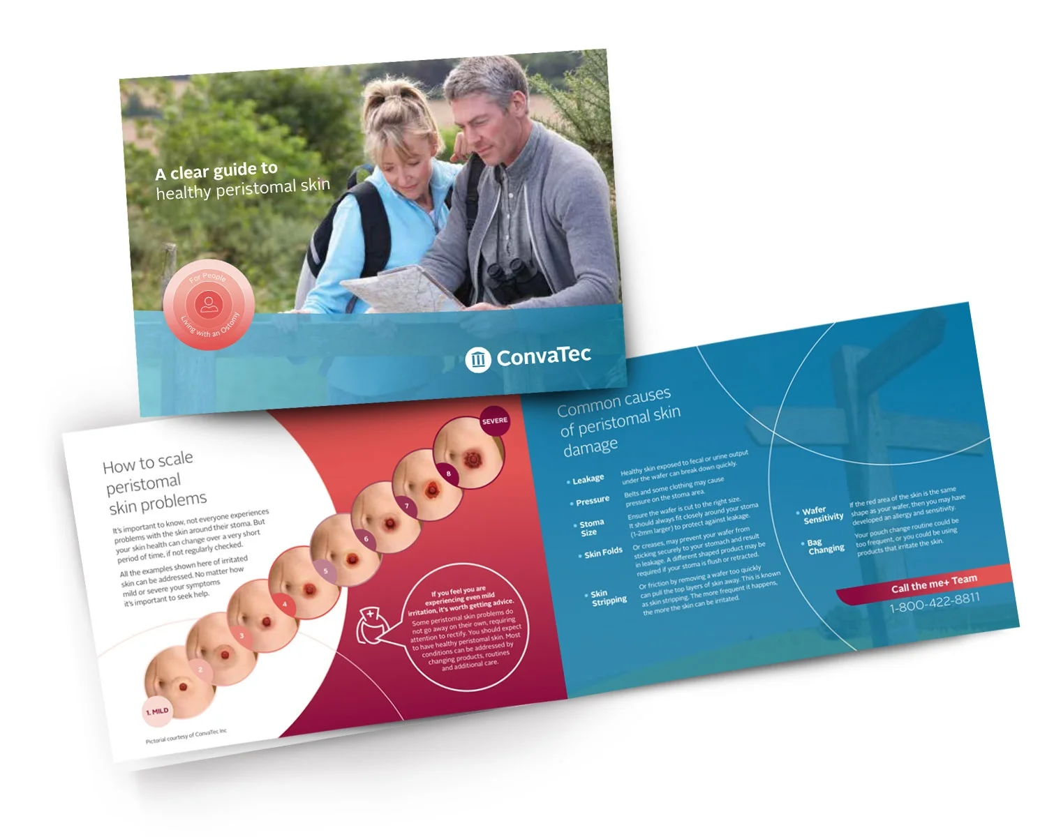 Una portada del folleto: 'Guía clara para una piel periestomal saludable' profundiza en los problemas de descamación y las causas comunes del daño a la piel.