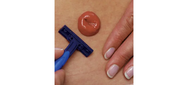 Die sechs Schritte des Versorgungswechsels &ndash; &nbsp;Schritt 4 Bild