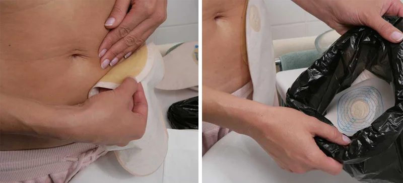 Die sechs Schritte des Versorgungswechsels &ndash;  Schritt 2 Bild