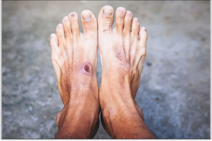 un par de pies con las uñas pintadas