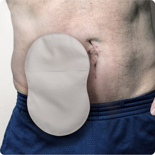 A closeup shot of a man using an 8-shaped ostomy pouch with Leak Defense™.